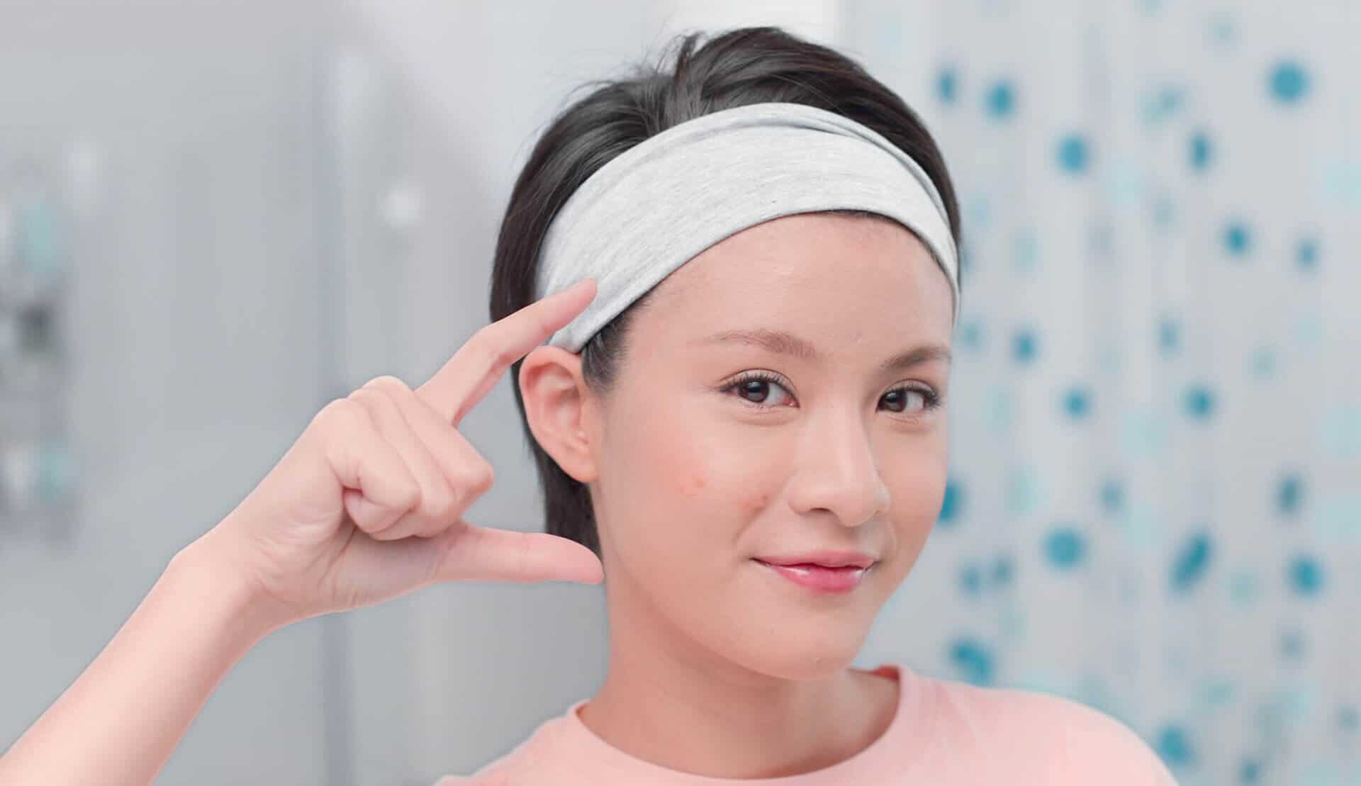 Acne Scarring ( Bahasa Article )